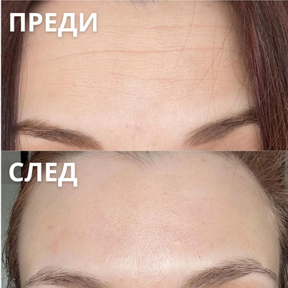 Стик-Балсам с PDRN За Бръчки
